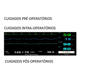 CUIDADOS PRÉ-OPERATÓRIOS

CUIDADOS INTRA-OPERATÓRIOS
   Clique para editar os estilos do texto mestre
   Segundo nível
    ● Terceiro nível

      ● Quarto nível

        ● Quinto nível




CUIDADOS PÓS-OPERATÓRIOS
 