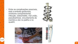• Entre as complicações possíveis,
está a embolia gordurosa,
síndrome compartimental,
infecção, osteomielite, mal união,
pseudoartrose, encurtamento do
membro e dor no joelho e no
quadril.
106
 
