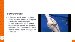 COMPLICAÇÕES
• infecção, restrição ou perda do
movimento do joelho, artrite pós-
traumática e consolidação
viciosa. Nas fraturas da patela,
os pacientes podem ter queixas
de dor e desconforto em torno da
patela, o que requer remoção do
implante.
109
 