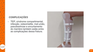 COMPLICAÇÕES
• TEP, síndrome compartimental,
infecção, osteomielite, mal união,
pseudoartrose e encurtamento
do membro também estão entre
as complicações dessa fratura.
111
 