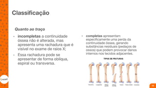 Classificação
Quanto ao traço
• incompletas a continuidade
óssea não é alterada, mas
apresenta uma rachadura que é
visível no exame de raios X;
• Essa rachadura pode se
apresentar de forma oblíqua,
espiral ou transversa.
• completas apresentam
especificamente uma perda da
continuidade óssea, gerando
substâncias residuais (pedaços de
ossos) que podem provocar danos
internos nos tecidos adjacentes.
15
 