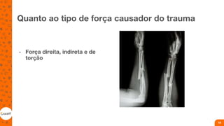 Quanto ao tipo de força causador do trauma
• Força direita, indireta e de
torção
19
 