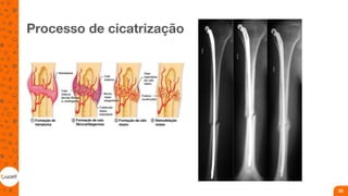 Processo de cicatrização
25
 