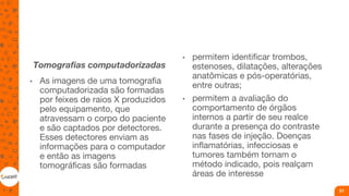 Tomografias computadorizadas
• As imagens de uma tomografia
computadorizada são formadas
por feixes de raios X produzidos
pelo equipamento, que
atravessam o corpo do paciente
e são captados por detectores.
Esses detectores enviam as
informações para o computador
e então as imagens
tomográficas são formadas
• permitem identificar trombos,
estenoses, dilatações, alterações
anatômicas e pós-operatórias,
entre outras;
• permitem a avaliação do
comportamento de órgãos
internos a partir de seu realce
durante a presença do contraste
nas fases de injeção. Doenças
inflamatórias, infecciosas e
tumores também tornam o
método indicado, pois realçam
áreas de interesse
51
 
