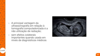 • A principal vantagem da
ultrassonografia em relação à
tomografia computadorizada é a
não utilização de radiação;
• sem efeitos colaterais
importantes quando usada em
níveis de diagnósticos médicos
54
 