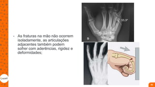 • As fraturas na mão não ocorrem
isoladamente, as articulações
adjacentes também podem
sofrer com aderências, rigidez e
deformidades;
93
 