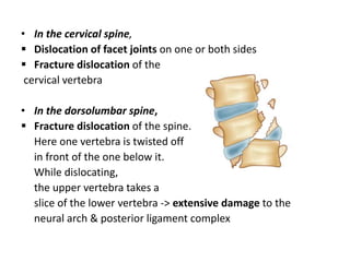 Complex Dislocation Trauma to cervical spine & thoracolumbar spine - Anatomy, Mechanism ...