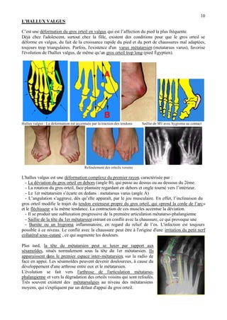 10
L'HALLUX VALGUS
C’est une déformation du gros orteil en valgus qui est l’affection du pied la plus fréquente.
Déjà chez l'adolescent, surtout chez la fille, existent des conditions pour que le gros orteil se
déforme en valgus, du fait de la croissance rapide du pied et du port de chaussures mal adaptées,
toujours trop triangulaires. Parfois, l'existence d'un varus métatarsien (metatarsus varus), favorise
l'évolution de l'hallux valgus, de même qu’un gros orteil trop long (pied Égyptien).
Hallux valgus : La déformation est accentuée par la traction des tendons Saillie de M1 avec hygroma au contact
Refoulement des orteils voisins
L'hallux valgus est une déformation complexe du premier rayon, caractérisée par :
- La déviation du gros orteil en dehors (angle B), qui passe au dessus ou au dessous du 2ème.
- La rotation du gros orteil, face plantaire regardant en dehors et ongle tourné vers l’intérieur.
- Le 1er métatarsien s’écarte en dedans : metatarsus varus (angle A)
- L’angulation s’aggrave, dès qu’elle apparaît, par le jeu musculaire. En effet, l’inclinaison du
gros orteil modifie le trajet du tendon extenseur propre du gros orteil, qui «prend la corde de l’arc»
et le fléchisseur a la même tendance. La contraction de ces muscles accentue la déviation.
- Il se produit une subluxation progressive de la première articulation métatarso-phalangienne
- Saillie de la tête du 1er métatarsienentrant en conflit avec la chaussure, ce qui provoque une
- Bursite ou un hygroma inflammatoire, en regard du relief de l’os. L'infection est toujours
possible à ce niveau. Le conflit avec la chaussure peut être à l'origine d'une irritation du petit nerf
collatéral sous-cutané , ce qui augmente les douleurs.
Plus tard, la tête du métatarsien peut se luxer par rapport aux
sésamoïdes, situés normalement sous la tête du 1er métatarsien. Ils
apparaissent dans le premier espace inter-métatarsien, sur la radio de
face en appui. Les sésamoïdes peuvent devenir douloureux, à cause du
développement d'une arthrose entre eux et le métatarsien.
L'évolution se fait vers l'arthrose de l'articulation métatarso-
phalangienne et vers la dégradation des orteils voisins qui sont refoulés.
Très souvent existent des métatarsalgies au niveau des métatarsiens
moyens, qui s'expliquent par un défaut d'appui du gros orteil.
 