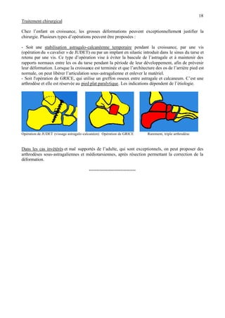 18
Traitement chirurgical
Chez l’enfant en croissance, les grosses déformations peuvent exceptionnellement justifier la
chirurgie. Plusieurs types d’opérations peuvent être proposées :
- Soit une stabilisation astragalo-calcanéenne temporaire pendant la croissance, par une vis
(opération du « cavalier » de JUDET) ou par un implant en silastic introduit dans le sinus du tarse et
retenu par une vis. Ce type d’opération vise à éviter la bascule de l’astragale et à maintenir des
rapports normaux entre les os du tarse pendant la période de leur développement, afin de prévenir
leur déformation. Lorsque la croissance est terminée et que l’architecture des os de l’arrière pied est
normale, on peut libérer l’articulation sous-astragalienne et enlever le matériel.
- Soit l'opération de GRICE, qui utilise un greffon osseux entre astragale et calcaneum. C’est une
arthrodèse et elle est réservée au pied plat paralytique. Les indications dépendent de l’étiologie.
Opération de JUDET (vissage astragalo-calcanéen) Opération de GRICE Rarement, triple arthrodèse
Dans les cas invétérés et mal supportés de l’adulte, qui sont exceptionnels, on peut proposer des
arthrodèses sous-astragaliennes et médiotarsiennes, après résection permettant la correction de la
déformation.
-------------------------------
 