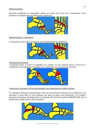 21
Métatarsectomies
Résection cunéiforme ou trapézoïdale portant au niveau de la base des 5 métatarsiens. Cette
opération est indiquée dans les déformations antérieures.
Métatarsectomies + arthrodèses
La résection est faite dans l’articulation tarso-métatarsienne de LISFRANC.
Tarsectomies antérieures
L’ostéotomie passe à travers le scaphoïde et le cuboïde. Le trait antérieur passe à travers les 3
cunéiformes. Cette opération est indiquée si le sommet du cavus est situé très en arrière.
Tarsectomies classiques et résection-arthrodèse sous-astragalienne et médio-tarsienne.
Ces opérations réduisent la dénivellation. Elles ont l'inconvénient de bloquer des articulations et de
raccourcir le pied. Elles ne sont indiquées que dans les pieds creux postérieurs. Il est parfois
nécessaire de réséquer davantage dans le calcaneum afin de l'horizontaliser (BERTRAND). On en
profite pour corriger aussi le varus calcanéen.
--------------------------------
 