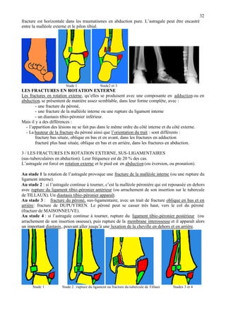32
fracture est horizontale dans les traumatismes en abduction pure. L’astragale peut être encastré
entre la malléole externe et le pilon tibial.
Stade 1 Stade2 et 3
LES FRACTURES EN ROTATION EXTERNE
Les fractures en rotation externe, qu’elles se produisent avec une composante en adduction ou en
abduction, se présentent de manière assez semblable, dans leur forme complète, avec :
- une fracture du péroné,
- une fracture de la malléole interne ou une rupture du ligament interne
- un diastasis tibio-péronier inférieur.
Mais il y a des différences :
- l’apparition des lésions ne se fait pas dans le même ordre du côté interne et du côté externe.
- La hauteur de la fracture du péroné ainsi que l’orientation du trait : sont différents :
fracture bas située, oblique en bas et en avant, dans les fractures en adduction
fracturé plus haut située, oblique en bas et en arrière, dans les fractures en abduction.
3 / LES FRACTURES EN ROTATION EXTERNE, SUS-LIGAMENTAIRES
(sus-tuberculaires en abduction). Leur fréquence est de 20 % des cas.
L’astragale est forcé en rotation externe et le pied est en abduction (ou éversion, ou pronation).
Au stade 1 la rotation de l’astragale provoque une fracture de la malléole interne (ou une rupture du
ligament interne).
Au stade 2 : si l’astragale continue à tourner, c’est la malléole péronière qui est repoussée en dehors
avec rupture du ligament tibio-péronier antérieur (ou arrachement de son insertion sur le tubercule
de TILLAUX). Un diastasis tibio-péronier apparaît.
Au stade 3 : fracture du péroné, sus-ligamentaire, avec un trait de fracture oblique en bas et en
arrière: fracture de DUPUYTREN. Le péroné peut se casser très haut, vers le col du péroné
(fracture de MAISONNEUVE).
Au stade 4 : si l’astragale continue à tourner, rupture du ligament tibio-péronier postérieur (ou
arrachement de son insertion osseuse), puis rupture de la membrane interosseuse et il apparaît alors
un important diastasis, pouvant aller jusqu’à une luxation de la cheville en dehors et en arrière.
Stade 1 Stade 2 : rupture du ligament ou fracture du tubercule de Tillaux Stades 3 et 4
 