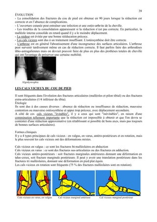 39
ÉVOLUTION
- La consolidation des fractures du cou de pied est obtenue en 90 jours lorsque la réduction est
correcte et en l’absence de complications.
- L’ouverture cutanée peut entraîner une infection et une ostéo-arthrite de la cheville.
- Les troubles de la consolidation apparaissent si la réduction n’est pas correcte. En particulier, la
malléole interne consolide en retard quand il y a le moindre déplacement.
- La raideur est évitée par une bonne rééducation précoce.
- Les cals vicieux sont dus à un traitement insuffisant. L'ostéosynthèse doit être correcte.
- L'arthrose est en général l'aboutissement d'une incongruence des surfaces articulaires. L'arthrose
peut survenir tardivement même en cas de réduction correcte. Il faut parfois faire des arthrodèses
tibio-astragaliennes mais on devrait pouvoir faire de plus en plus des prothèses totales de cheville
qui ont l'avantage de préserver une certaine mobilité.
Algodystrophie
LES CALS VICIEUX DU COU DE PIED
Il sont fréquents dans l'évolution des fractures articulaires (malléoles et pilon tibial) ou des fractures
extra-articulaires (1/4 inférieur du tibia).
Étiologie
Ils sont dus à des causes diverses : absence de réduction ou insuffisance de réduction, mauvaise
contention ou mauvaise ostéosynthèse et appui trop précoce, avec déplacement secondaire.
A côté de ces cals vicieux "évitables", il y a ceux qui sont "inévitables", en raison d'une
comminution tellement importante que la réduction est impossible à obtenir et que l'on devra se
contenter d'une réduction approximative (en rétablissant si possible de bons axes, mais pas toujours
de bonnes surfaces articulaires).
Formes cliniques
Il y a 4 types principaux de cals vicieux : en valgus, en varus, antéro-postérieurs et en rotation, mais
le plus souvent les cals vicieux ont des déformations mixtes.
Cals vicieux en valgus : ce sont les fractures bi-malléolaires en abduction
Cals vicieux en varus : ce sont des fractures sus-articulaires ou des fractures en adduction.
Cals vicieux antéro-postérieurs : soit fractures marginales antérieures donnant une déformation en
talus-creux, soit fracture marginale postérieure. Il peut y avoir une translation postérieure dans les
fractures tri malléolaires, donnant une déformation en pied plat équin.
Les cals vicieux en rotation sont fréquents (75 % des fractures malléolaires sont en rotation).
Cals vicieux en varus, en valgus Cal vicieux marginal antérieur Cal vicieux marginal postérieur
 