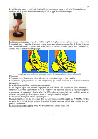 47
La rééducation proprioceptive de la cheville sera entreprise après la période d'immobilisation,
quel que soit la gravité de l'entorse et quel que soit le type de traitement adopté.
Le traitement chirurgical est parfois préféré au plâtre simple dans les ruptures graves, surtout chez
les sujets jeunes et sportifs : il consiste en une suture des faisceaux rompus dans le but de favoriser
une cicatrisation mieux organisée des fibres rompues. L'immobilisation plâtrée suit l'intervention,
comme pour le traitement orthopédique.
2 exemples parmi de nombreuses techniques possibles de ligamentoplasties externes de la cheville
L'évolution
L'évolution est le plus souvent, favorable avec un traitement adapté et bien conduit.
Le syndrome algodystrophique est une complication qui se voit rarement si la marche est reprise
rapidement.
Le syndrome d'instabilité chronique et douloureuse
Il est fréquent après des entorses négligées ou mal traitées. Le tableau est celui d'entorses à
répétition. La laxité ligamentaire mise en évidence par l'examen clinique et les radiographies
dynamiques est supérieure à l'autre côté. La rééducation proprioceptive bien conduite permet se
stabiliser une grande partie de ces cas, sinon la chirurgie peut être indiquée.
Le traitement chirurgical est une ligamentoplastie
Plusieurs opérations ont été proposées, dont les plus utilisées sont le procécé de WATSON JONES
ou celui de CASTAING qui utilisent le tendon du court péronier latéral. Les résultats sont en
général satisfaisants.
La rééducation proprioceptive devra être prescrite avant, comme après, l'op
----------------------------------
 
