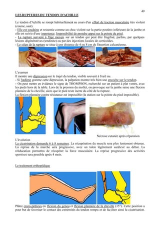 49
LES RUPTURES DU TENDON D'ACHILLE
Le tendon d'Achille se rompt habituellement au cours d'un effort de traction musculaire très violent
(course, saut).
- Elle est soudaine et ressentie comme un choc violent sur la partie postéro-inférieure de la jambe et
elle est suivie d'une impotence. Impossibilité de prendre appui sur la pointe du pied.
- La rupture survient à l'âge moyen, sur un tendon qui peut être fragilisé, parfois, par quelques
lésions dégénératives (tendinite) ou par des injections locales de corticoïdes.
- Le siège de la rupture se situe à une distance de 4 ou 8 cm de l'insertion calcanéenne.
L'examen
Il montre une dépression sur le trajet du tendon, visible souvent à l'oeil nu.
- Si l'œdème gomme cette dépression, la palpation montre très bien une encoche sur le tendon.
- On peut mettre en évidence le signe de THOMPSON, recherché sur un patient à plat ventre, avec
les pieds hors de la table. Lors de la pression du mollet, on provoque sur la jambe saine une flexion
plantaire de la cheville, alors que le pied reste inerte du côté de la rupture.
La flexion plantaire contre résistance est impossible (la station sur la pointe du pied impossible).
Nécrose cutanée après réparation
L'évolution
La cicatrisation demande 6 à 8 semaines. La récupération du muscle sera plus lentement obtenue.
La reprise de la marche sera progressive, avec un talon légèrement surélevé au début. La
rééducation permettra de récupérer la force musculaire. La reprise progressive des activités
sportives sera possible après 4 mois.
Le traitement orthopédique
Plâtre cruro-pédieux en flexion du genou et flexion plantaire de la cheville (15°). Cette position a
pour but de favoriser le contact des extrémités du tendon rompu et de faciliter ainsi la cicatrisation.
 