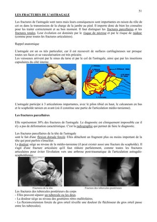 51
LES FRACTURES DE L'ASTRAGALE
Les fractures de l'astragale sont rares mais leurs conséquences sont importantes en raison du rôle de
cet os dans la transmission de la charge de la jambe au pied. Il importe donc de bien les connaître
pour les traiter correctement et au bon moment. Il faut distinguer les fractures parcellaires et les
fractures totales. Leur évolution est dominée par le risque de nécrose et par le risque de raideur
(comme pour toutes les fractures articulaires).
Rappel anatomique
L'astragale est un os très particulier, car il est recouvert de surfaces cartilagineuses sur presque
toutes ses faces et sa vascularisation est très précaire.
Les vaisseaux arrivent par le sinus du tarse et par le col de l'astragale, ainsi que par les insertions
capsulaires du côté interne.
L'astragale participe à 3 articulations importantes, avec le pilon tibial en haut, le calcaneum en bas
et le scaphoïde tarsien en avant (où il constitue une partie de l'articulation médio-tarsienne).
Les fractures parcellaires
Elle représentent 30% des fractures de l'astragale. Le diagnostic est cliniquement impossible car il
n'y a pas de déformation caractéristique. C'est la radiographie qui permet de faire le diagnostic.
Les fractures parcellaires de la tête de l'astragale
sont le fait d'une flexion dorsale forcée. Elles détachent un fragment plus ou moins important de la
tête qui peut parfois s'énucléer.
La douleur siège au niveau de la médio-tarsienne (il peut exister aussi une fracture du scaphoïde). Il
s'agit d'une fracture articulaire qu'il faut réduire parfaitement, comme toutes les fractures
articulaires pour éviter l'évolution vers une arthrose post-traumatique de l'articulation astragalo-
scaphoïdienne.
Fractures de la tête Fracture des tubercules postérieurs
Les fractures des tubercules postérieurs du corps
- Elles peuvent séparer un tubercule ou les deux.
- La douleur siège au niveau des gouttières rétro-malléolaires.
- La flexion-extension forcée du gros orteil réveille une douleur (le fléchisseur du gros orteil passe
entre les tubercules).
 