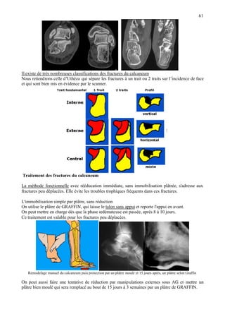 61
Il existe de très nombreuses classifications des fractures du calcaneum
Nous retiendrons celle d’Uthéza qui sépare les fractures à un trait ou 2 traits sur l’incidence de face
et qui sont bien mis en évidence par le scanner.
Traitement des fractures du calcaneum
La méthode fonctionnelle avec rééducation immédiate, sans immobilisation plâtrée, s'adresse aux
fractures peu déplacées. Elle évite les troubles trophiques fréquents dans ces fractures.
L'immobilisation simple par plâtre, sans réduction
On utilise le plâtre de GRAFFIN, qui laisse le talon sans appui et reporte l'appui en avant.
On peut mettre en charge dès que la phase œdémateuse est passée, après 8 à 10 jours.
Ce traitement est valable pour les fractures peu déplacées.
Remodelage manuel du calcaneum puis protection par un plâtre moulé et 15 jours après, un plâtre selon Graffin
On peut aussi faire une tentative de réduction par manipulations externes sous AG et mettre un
plâtre bien moulé qui sera remplacé au bout de 15 jours à 3 semaines par un plâtre de GRAFFIN.
 