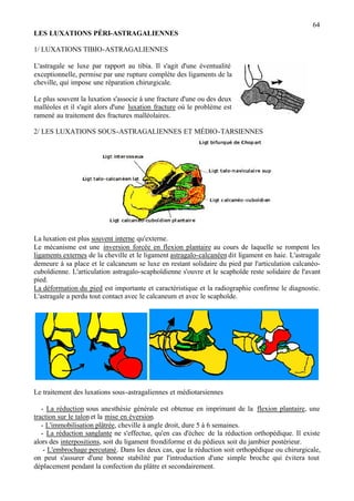 64
LES LUXATIONS PÉRI-ASTRAGALIENNES
1/ LUXATIONS TIBIO-ASTRAGALIENNES
L'astragale se luxe par rapport au tibia. Il s'agit d'une éventualité
exceptionnelle, permise par une rupture complète des ligaments de la
cheville, qui impose une réparation chirurgicale.
Le plus souvent la luxation s'associe à une fracture d'une ou des deux
malléoles et il s'agit alors d'une luxation fracture où le problème est
ramené au traitement des fractures malléolaires.
2/ LES LUXATIONS SOUS-ASTRAGALIENNES ET MÉDIO-TARSIENNES
La luxation est plus souvent interne qu'externe.
Le mécanisme est une inversion forcée en flexion plantaire au cours de laquelle se rompent les
ligaments externes de la cheville et le ligament astragalo-calcanéen dit ligament en haie. L'astragale
demeure à sa place et le calcaneum se luxe en restant solidaire du pied par l'articulation calcanéo-
cuboïdienne. L'articulation astragalo-scaphoïdienne s'ouvre et le scaphoïde reste solidaire de l'avant
pied.
La déformation du pied est importante et caractéristique et la radiographie confirme le diagnostic.
L'astragale a perdu tout contact avec le calcaneum et avec le scaphoïde.
Le traitement des luxations sous-astragaliennes et médiotarsiennes
- La réduction sous anesthésie générale est obtenue en imprimant de la flexion plantaire, une
traction sur le talonet la mise en éversion.
- L'immobilisation plâtrée, cheville à angle droit, dure 5 à 6 semaines.
- La réduction sanglante ne s'effectue, qu'en cas d'échec de la réduction orthopédique. Il existe
alors des interpositions, soit du ligament frondiforme et du pédieux soit du jambier postérieur.
- L'embrochage percutané. Dans les deux cas, que la réduction soit orthopédique ou chirurgicale,
on peut s'assurer d'une bonne stabilité par l'introduction d'une simple broche qui évitera tout
déplacement pendant la confection du plâtre et secondairement.
 