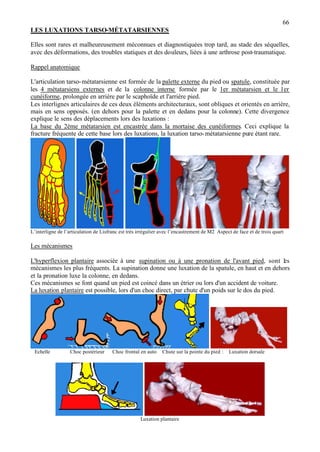 66
LES LUXATIONS TARSO-MÉTATARSIENNES
Elles sont rares et malheureusement méconnues et diagnostiquées trop tard, au stade des séquelles,
avec des déformations, des troubles statiques et des douleurs, liées à une arthrose post-traumatique.
Rappel anatomique
L'articulation tarso-métatarsienne est formée de la palette externe du pied ou spatule, constituée par
les 4 métatarsiens externes et de la colonne interne formée par le 1er métatarsien et le 1er
cunéiforme, prolongée en arrière par le scaphoïde et l'arrière pied.
Les interlignes articulaires de ces deux éléments architecturaux, sont obliques et orientés en arrière,
mais en sens opposés. (en dehors pour la palette et en dedans pour la colonne). Cette divergence
explique le sens des déplacements lors des luxations :
La base du 2ème métatarsien est encastrée dans la mortaise des cunéiformes. Ceci explique la
fracture fréquente de cette base lors des luxations, la luxation tarso-métatarsienne pure étant rare.
L’interligne de l’articulation de Lisfranc est très irrégulier avec l’encastrement de M2 Aspect de face et de trois quart
Les mécanismes
L'hyperflexion plantaire associée à une supination ou à une pronation de l'avant pied, sont les
mécanismes les plus fréquents. La supination donne une luxation de la spatule, en haut et en dehors
et la pronation luxe la colonne, en dedans.
Ces mécanismes se font quand un pied est coincé dans un étrier ou lors d'un accident de voiture.
La luxation plantaire est possible, lors d'un choc direct, par chute d'un poids sur le dos du pied.
Echelle Choc postérieur Choc frontal en auto Chute sur la pointe du pied : Luxation dorsale
Luxation plantaire
 
