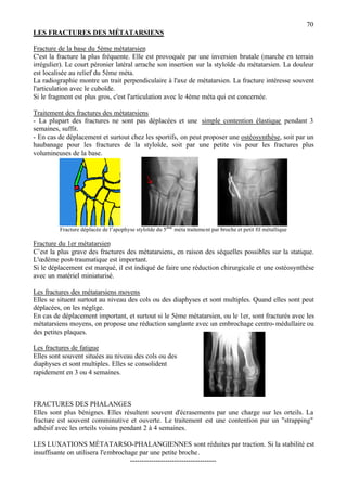 70
LES FRACTURES DES MÉTATARSIENS
Fracture de la base du 5ème métatarsien
C'est la fracture la plus fréquente. Elle est provoquée par une inversion brutale (marche en terrain
irrégulier). Le court péronier latéral arrache son insertion sur la styloïde du métatarsien. La douleur
est localisée au relief du 5ème méta.
La radiographie montre un trait perpendiculaire à l'axe de métatarsien. La fracture intéresse souvent
l'articulation avec le cuboïde.
Si le fragment est plus gros, c'est l'articulation avec le 4ème méta qui est concernée.
Traitement des fractures des métatarsiens
- La plupart des fractures ne sont pas déplacées et une simple contention élastique pendant 3
semaines, suffit.
- En cas de déplacement et surtout chez les sportifs, on peut proposer une ostéosynthèse, soit par un
haubanage pour les fractures de la styloïde, soit par une petite vis pour les fractures plus
volumineuses de la base.
Fracture déplacée de l’apophyse styloïde du 5ème
méta traitement par broche et petit fil métallique
Fracture du 1er métatarsien
C’est la plus grave des fractures des métatarsiens, en raison des séquelles possibles sur la statique.
L'œdème post-traumatique est important.
Si le déplacement est marqué, il est indiqué de faire une réduction chirurgicale et une ostéosynthèse
avec un matériel miniaturisé.
Les fractures des métatarsiens moyens
Elles se situent surtout au niveau des cols ou des diaphyses et sont multiples. Quand elles sont peut
déplacées, on les néglige.
En cas de déplacement important, et surtout si le 5ème métatarsien, ou le 1er, sont fracturés avec les
métatarsiens moyens, on propose une réduction sanglante avec un embrochage centro-médullaire ou
des petites plaques.
Les fractures de fatigue
Elles sont souvent situées au niveau des cols ou des
diaphyses et sont multiples. Elles se consolident
rapidement en 3 ou 4 semaines.
FRACTURES DES PHALANGES
Elles sont plus bénignes. Elles résultent souvent d'écrasements par une charge sur les orteils. La
fracture est souvent comminutive et ouverte. Le traitement est une contention par un "strapping"
adhésif avec les orteils voisins pendant 2 à 4 semaines.
LES LUXATIONS MÉTATARSO-PHALANGIENNES sont réduites par traction. Si la stabilité est
insuffisante on utilisera l'embrochage par une petite broche.
-------------------------------------
 