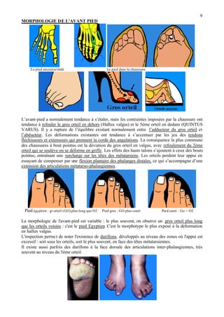 9
MORPHOLOGIE DE L’AVANT PIED
Le pied ancestral étalé Le pied dans la chaussure
L’avant-pied a normalement tendance à s’étaler, mais les contraintes imposées par la chaussure ont
tendance à refouler le gros orteil en dehors (Hallux valgus) et le 5ème orteil en dedans (QUINTUS
VARUS). Il y a rupture de l’équilibre existant normalement entre l’adducteur du gros orteil et
l’abducteur. Les déformations existantes ont tendance à s’accentuer par les jeu des tendons
fléchisseurs et extenseurs qui prennent la corde des angulations. La conséquence la plus commune
des chaussures à bout pointus est la déviation du gros orteil en valgus, avec refoulement du 2ème
orteil qui se soulève ou se déforme en griffe. Les effets des hauts talons s’ajoutent à ceux des bouts
pointus, entraînant une surcharge sur les têtes des métatarsiens. Les orteils perdent leur appui en
essayant de compenser par une flexion plantaire des phalanges distales, ce qui s’accompagne d’une
extension des articulations métatarso-phalangiennes.
Pied égyptien : gr orteil (GO) plus long que O2 Pied grec : GO plus court Pied carré : Go = O2
La morphologie de l'avant-pied est variable : le plus souvent, on observe un gros orteil plus long
que les orteils voisins : c'est le pied Egyptien. C'est le morphotype le plus exposé à la déformation
en hallux valgus.
L'inspection permet de noter l'existence de durillons, développés au niveau des zones où l'appui est
excessif : soit sous les orteils, soit le plus souvent, en face des têtes métatarsiennes.
Il existe aussi parfois des durillons à la face dorsale des articulations inter-phalangiennes, très
souvent au niveau du 5ème orteil.
 
