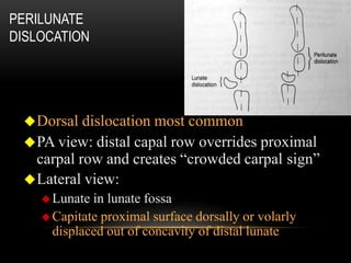 Trauma to extremities (1) | PPTX