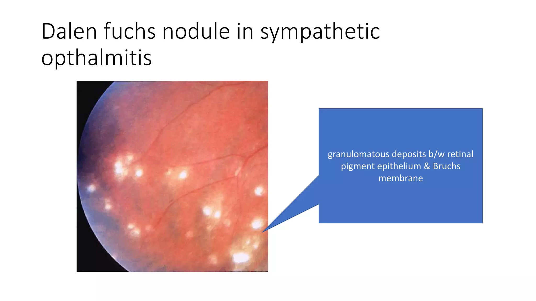 Trauma to eye REVISION NOTES | PPTX