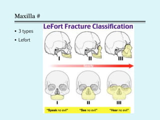Maxilla #
 3 types
 Lefort
 