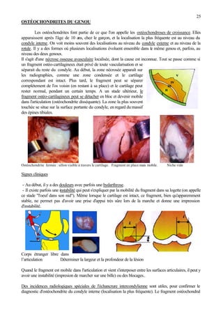 25
OSTÉOCHONDRITES DU GENOU
Les ostéochondrites font partie de ce que l'on appelle les ostéochondroses de croissance. Elles
apparaissent après l'âge de 10 ans, chez le garçon, et la localisation la plus fréquente est au niveau du
condyle interne. On voit moins souvent des localisations au niveau du condyle externe et au niveau de la
rotule. Il y a des formes où plusieurs localisations évoluent ensemble dans le même genou et, parfois, au
niveau des deux genoux.
Il s'agit d'une nécrose osseuse avasculaire localisée, dont la cause est inconnue. Tout se passe comme si
un fragment ostéo-cartilagineux était privé de toute vascularisation et se
séparait du reste du condyle. Au début, la zone nécrosée apparaît sur
les radiographies, comme une zone condensée et le cartilage
correspondant est intact. Plus tard, le fragment peut se séparer
complètement de l'os voisin (en restant à sa place) et le cartilage peut
rester normal, pendant un certain temps. A un stade ultérieur, le
fragment ostéo-cartilagineux peut se détacher en bloc et devenir mobile
dans l'articulation (ostéochondrite disséquante). La zone la plus souvent
touchée se situe sur la surface portante du condyle, en regard du massif
des épines tibiales.
Ostéochondrite fermée : sillon visible à travers le cartilage. Fragment en place mais mobile. Niche vide
Signes cliniques
- Au début, il y a des douleurs avec parfois une hydarthrose.
- Il existe parfois une instabilité qui peut s'expliquer par la mobilité du fragment dans sa logette (on appelle
ce stade "l'oeuf dans son nid"). Même lorsque le cartilage est intact, ce fragment, bien qu'apparemment
stable, ne permet pas d'avoir une prise d'appui très sûre lors de la marche et donne une impression
d'instabilité.
Corps étranger libre dans
l’articulation Déterminer la largeur et la profondeur de la lésion
Quand le fragment est mobile dans l'articulation et vient s'interposer entre les surfaces articulaires, il peut y
avoir une instabilité (impresion de marcher sur une bille) ou des blocages..
Des incidences radiologiques spéciales de l'échancrure intercondylienne sont utiles, pour confirmer le
diagnostic d'ostéochondrite du condyle interne (localisation la plus fréquente). Le fragment ostéochondral
 