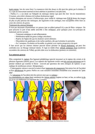 30
laxité externe, lors du varus forcé. La manœuvre doit être douce et elle peut être gênée par la douleur. Il
n’y a pas de mouvement anormal en tiroir antérieur ni postérieur (voir plus loin).
- Parfois, il y a un doute sur l'intégrité du ménisque interne (qui peut être lésé lors du traumatisme).
L'examen, sera refait à distance de la phase douloureuse aiguë
Certains chirurgiens ont recours à l'arthroscopie, pour vérifier le ménisque mais l'I.R.M donne des images
de plus en plus précises des ménisques, des ligaments et des cartilages, tous susceptibles d'être lésés au
cours des entorses du genou.
Traitement des entorses bénignes
Il n'est pas nécessaire d'immobiliser ces genoux (par un plâtre) puisqu'il n'y a pas de fibres rompues. On
peut prescrire le port d’une attelle amovible à titre antalgique, pour quelques jours. Les principes du
traitement sont les suivants :
- Traitement antalgique et anti-inflammatoire.
- Mobilisation rapide du genou (rodage articulaire).
- Reprise de l'appui dès que les douleurs seront atténuées.
- Musculation du quadriceps et des ischio-jambiers, dès que la douleur le permettra.
- En 3 semaines, l'évolution est favorable, en général, avec reprise progressive du sport
Il faut savoir que les entorses internes peuvent laisser persister un flexum douloureux, qui peut être
confondu avec un blocage méniscal interne. Il s'agit en réalité d'une attitude antalgique fixée (syndrome
secondaire des entorses de Trillat), qui doit céder avec la rééducation (postures en extension).
Les entorses graves
Elles comportent la rupture d'un ligament périphérique (gravité moyenne) ou la rupture des croisés et de
plusieurs ligaments (entorse grave). Les ruptures des ligaments croisés sont très souvent méconnues par le
premier médecin qui examine le blessé (souvent par ignorance des tests cliniques de rupture) ce qui
explique de nombreuses erreurs thérapeutiques.
- L'interrogatoire retrouve souvent la notion d'une impression de craquement, bien perçu lors de l'accident
et d'un déboîtement du genou. Parfois on a une sensation immédiate d'instabilité avec sensation de "patte
folle".
- Le mécanisme de l'accident doit être précisé ainsi que sa violence :
Les traumatismes en valgus forcé entraînent des lésions internes (rupture en haut, en bas, au milieu) et du
LCA (et si le bâillement est important des 2 croisés).
Rupture des 2 ligaments croisés et de toutes les formations internes
 