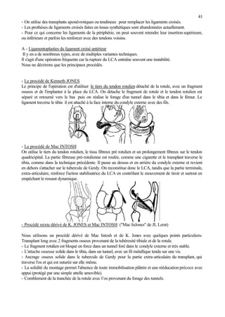 41
- On utilise des transplants aponévrotiques ou tendineux pour remplacer les ligaments croisés.
- Les prothèses de ligaments croisés faites en tissus synthétiques sont abandonnées actuellement.
- Pour ce qui concerne les ligaments de la périphérie, on peut souvent retendre leur insertion supérieure,
ou inférieure et parfois les renforcer avec des tendons voisins.
A - Ligamentoplasties du ligament croisé antérieur
Il y en a de nombreux types, avec de multiples variantes techniques.
Il s'agit d'une opération fréquente car la rupture du LCA entraîne souvent une instabilité.
Nous ne décrirons que les principaux procédés.
- Le procédé de Kenneth JONES
Le principe de l'opération est d'utiliser le tiers du tendon rotulien détaché de la rotule, avec un fragment
osseux et de l'implanter à la place du LCA. On détache le fragment de rotule et le tendon rotulien est
séparé et retourné vers le bas puis on réalise le forage d'un tunnel dans le tibia et dans le fémur. Le
ligament traverse le tibia il est attaché à la face interne du condyle externe avec des fils.
- Le procédé de Mac INTOSH
On utilise le tiers du tendon rotulien, le tissu fibreux pré rotulien et un prolongement fibreux sur le tendon
quadricipital. La partie fibreuse pré-rotulienne est roulée, comme une cigarette et le transplant traverse le
tibia, comme dans la technique précédente. Il passe au dessus et en arrière du condyle externe et revient
en dehors s'attacher sur le tubercule de Gerdy. On reconstitue donc le LCA, tandis que la partie terminale,
extra-articulaire, renforce l'action stabilisatrice du LCA en contrôlant le mouvement de tiroir et surtout en
empêchant le ressaut dynamique.
- Procédé mixte dérivé de K. JONES et Mac INTOSH ("Mac InJones" de JL Lerat)
Nous utilisons un procédé dérivé de Mac Intosh et de K. Jones avec quelques points particuliers-
Transplant long avec 2 fragments osseux provenant de la tubérosité tibiale et de la rotule.
- Le fragment rotulien est bloqué en force dans un tunnel foré dans le condyle externe et très stable.
- L'attache osseuse solide dans le tibia, dans un tunnel, avec un fil métallique tendu sur une vis.
- Ancrage osseux solide dans le tubercule de Gerdy pour la partie extra-articulaire du transplant, qui
traverse l'os et qui est suturée sur elle même.
- La solidité du montage permet l'absence de toute immobilisation plâtrée et une rééducation précoce avec
appui (protégé par une simple attelle amovible).
- Comblement de la tranchée de la rotule avec l’os provenant du forage des tunnels.
 