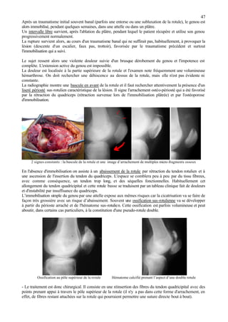 47
Après un traumatisme initial souvent banal (parfois une entorse ou une subluxation de la rotule), le genou est
alors immobilisé, pendant quelques semaines, dans une attelle ou dans un plâtre.
Un intervalle libre survient, après l'ablation du plâtre, pendant lequel le patient récupère et utilise son genou
progressivement normalement.
La rupture survient alors, au cours d'un traumatisme banal qui ne suffirait pas, habituellement, à provoquer la
lésion (descente d'un escalier, faux pas, trottoir), favorisée par le traumatisme précédent et surtout
l'immobilisation qui a suivi.
Le sujet ressent alors une violente douleur suivie d'un brusque dérobement du genou et l'impotence est
complète. L'extension active du genou est impossible.
La douleur est localisée à la partie supérieure de la rotule et l'examen note fréquemment une volumineuse
hémarthrose. On doit rechercher une déhiscence au dessus de la rotule, mais elle n'est pas évidente ni
constante.
La radiographie montre une bascule en avant de la rotule et il faut rechercher attentivement la présence d'un
liseré périosté sus-rotulien caractéristique de la lésion. Il signe l'arrachement ostéo-périosté qui a été favorisé
par la rétraction du quadriceps (rétraction survenue lors de l'immobilisation plâtrée) et par l'ostéoporose
d'immobilisation.
2 signes constants : la bascule de la rotule et une image d’arrachement de multiples micro-fragments osseux
En l'absence d'immobilisation on assiste à un abaissement de la rotule par rétraction du tendon rotulien et à
une ascension de l'insertion du tendon du quadriceps. L'espace se comblera peu à peu par du tissu fibreux,
avec comme conséquence, un tendon trop long, et des séquelles fonctionnelles. Habituellement cet
allongement du tendon quadricipital et cette rotule basse se traduisent par un tableau clinique fait de douleurs
et d'instabilité par insuffisance du quadriceps.
L’immobilisation simple du genou par une attelle expose aux mêmes risques car la cicatrisation va se faire de
façon très grossière avec un risque d’abaissement. Souvent une ossification sus-rotulienne va se développer
à partir du périoste arraché et de l'hématome sus-rotulien. Cette ossification est parfois volumineuse et peut
aboutir, dans certains cas particuliers, à la constitution d'une pseudo-rotule double.
Ossification au pôle supérieur de la rotule Hématome calcifié prenant l’aspect d’une double rotule
- Le traitement est donc chirurgical. Il consiste en une réinsertion des fibres du tendon quadricipital avec des
points prenant appui à travers le pôle supérieur de la rotule (il n'y a pas dans cette forme d'arrachement, en
effet, de fibres restant attachées sur la rotule qui pourraient permettre une suture directe bout à bout).
 