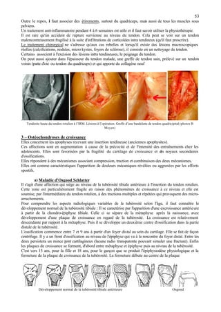 53
Outre le repos, il faut associer des étirements, surtout du quadriceps, mais aussi de tous les muscles sous
pelviens.
Un traitement anti-inflammatoire pendant 4 à 6 semaines est utile et il faut savoir utiliser la physiothérapie.
Il est rare qu'un accident de rupture survienne au niveau du tendon. Cela peut se voir sur un tendon
malencontreusement fragilisé à la suite d'infiltrations de corticoïdes intra tendineux (qu'il faut proscrire).
Le traitement chirurgical ne s'adresse qu'aux cas rebelles et lorsqu'il existe des lésions macroscopiques
réelles (calcifications, nodules, micro kystes, foyers de sclérose), il consiste en un nettoyage du tendon.
Certains associent à l'excision des lésions intra tendineuses, le peignage du tendon.
On peut aussi ajouter dans l'épaisseur du tendon malade, une greffe de tendon sain, prélevé sur un tendon
voisin (patte d'oie ou tendon du quadriceps) et qui apporte du collagène neuf
.
Tendinite haute du tendon rotulien à l’IRM. Lésions à l’opération. Greffe d’une bandelette de tendon quadricipital (photos B
Moyen)
3 – Ostéochondroses de croissance
Elles concernent les apophyses recevant une insertion tendineuse (anciennes apophysites).
Ces affections sont en augmentation à cause de la précocité et de l'intensité des entraînements chez les
adolescents. Elles sont favorisées par la fragilité du cartilage de croissance et des noyaux secondaires
d'ossifications.
Elles répondent à des mécanismes associant compression, traction et combinaison des deux mécanismes.
Elles ont comme caractéristiques l'apparition de douleurs mécaniques révélées ou aggravées par les efforts
sportifs.
a) Maladie d'Osgood Schlatter
Il s'agit d'une affection qui siège au niveau de la tubérosité tibiale antérieure à l'insertion du tendon rotulien.
Cette zone est particulièrement fragile en raison des phénomènes de croissance à ce niveau et elle est
soumise, par l'intermédiaire du tendon rotulien, à des tractions multiples et répétées qui provoquent des micro-
arrachements.
Pour comprendre les aspects radiologiques variables de la tubérosité selon l'âge, il faut connaître le
développement normal de la tubérosité tibiale : Il se caractérise par l'apparition d'une excroissance antérieure
à partir de la chondro-épiphyse tibiale. Celle ci se sépare de la métaphyse après la naissance, avec
développement d'une plaque de croissance en regard de la tubérosité. La croissance est relativement
descendante par rapport à la métaphyse. Puis il se développe un deuxième centre d'ossification dans la partie
distale de la tubérosité.
L'ossification commence entre 7 et 9 ans à partir d'un foyer distal au sein du cartilage. Elle se fait de façon
centrifuge. Il y a un front d'ossification au niveau de l'épiphyse qui va à la rencontre du foyer distal. Entre les
deux persistera un mince pont cartilagineux (lacune radio transparente pouvant simuler une fracture). Enfin
les plaques de croissance se ferment, d'abord entre métaphyse et épiphyse puis au niveau de la tubérosité.
C'est vers 15 ans, pour la fille et 18 ans, pour le garçon que se produit l'épiphysiodèse physiologique et la
fermeture de la plaque de croissance de la tubérosité. La fermeture débute au centre de la plaque
Développement normal de la tubérosité tibiale antérieure Osgood
 