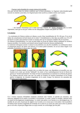 59
- Fracture ostéo-chondrale du versant externe de la trochlée
Elle peut survenir dans les mêmes conditions que la lésion précédente. Le fragment ostéo-chondral garde
souvent ses attaches synoviales et le fragment peut rester accolé au condyle externe (sur la joue)
- une luxation traumatique de la rotule provoque toujours des lésions chondrales plus ou moins
importantes, mais qui ne sont pas visibles sur des radiographies simples mais plutôt sur l’IRM.
L'évolution
- La cicatrisation de l'aileron rotulien est obtenue au prix d'une immobilisation de 30 à 40 jours. Il en est de
même des arrachements du bord interne de la rotule. L’immobilisation se fera dans une attelle avec 10 à 15°
de flexion car dans cette position la rotule se recentre alors qu’en extension complète elle est excentrée.
En l'absence d'immobilisation, il se crée un point faible au niveau de l'aileron interne expliquant les récidives
toujours possibles. Ces récidives surviennent surtout lorsqu'il existe des facteurs prédisposants.
Le traitement chirurgical consiste à suturer la zone déchirée avec des fils résorbables. La mobilisation douce
et uniquement passive du genou sera précoce si la suture parait résistante. En cas de suture fragile il est
préférable d'immobiliser le genou dans une attelle.
Lorsque la luxation initiale se produit chez un enfant très jeune, une dégradation est possible avec une
luxation de la rotule qui devient "habituelle" (la rotule se luxe systématiquement lors de la flexion du
genou) ou "luxation permanente" (la rotule est luxée en permanence en extension et en flexion du genou).
Ces tableaux peuvent exister sans que l’on mette en évidence de luxation traumatique et l’on évoque
parfois le diagnostic de «luxation congénitale» de la rotule, lorsque l’on découvre ces anomalies par
hasard et assez tardivement.
Ces 2 formes majeures d'instabilité rotulienne entraînent chez l'enfant, en période de croissance, une
mauvaise adaptation de la rotule à la trochlée et inversement. La rotule, comme la trochlée, subissent alors
un retard de développement morphologique. La rotule reste petite et ses facettes ne se développent pas. La
trochlée de son coté, n'ayant pas de rapport avec la rotule, ne se creuse pas et reste plate. Cela ressemble à
l'évolution d'une luxation congénitale de la hanche où le cotyle ne se creuse pas, parce que la tête n'y pénètre
pas et où la tête, n'ayant pas d'appui dans un cotyle normal, ne se développe pas non plus.
 