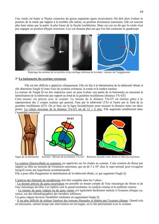 64
Une rotule est haute si l'hyper extension du genou augmente (genu recurvatum). On doit alors évaluer la
position de la rotule par rapport à la trochlée elle même, en position d'extension maximum. Elle est souvent
plus haut située que la partie la plus haute de la facette trochléenne. Dans ces cas on dit que la rotule n'est
pas engagée en position d'hyper extension. Ceci est d'autant plus net que l'on fait contracter le quadriceps.
Repérage du sommet de la trochlée et du cartilage inférieur de la rotule : mesure de l’engagement
3° La baïonnette du système extenseur
Elle est très difficile à apprécier cliniquement. Elle est liée à la latéralisation de la tubérosité tibiale et
elle détermine l'angle Q entre l'axe du système extenseur, la rotule et le tendon rotulien.
La mesure de l'angle Q est très imprécise mais on peut évaluer une partie de la baïonnette en mesurant la
latéralisation de la tubérosité par rapport au fond de la gouttière trochléenne (distance TA-GT)
Cette mesure est précise avec le scanner. La mesure de la distance TA-GT est réalisée grâce à la
superposition des 2 coupes scanner qui passent, l'une par la tubérosité (TA) et l'autre par le fond de la
gouttière trochléenne (GT). On se base sur la ligne bicondylienne pour mesurer la distance entre ces deux
points. La valeur moyenne de la distance TA-GT est de 12 ± 6 mm. Elle augmente notablement dans
l’instabilité rotulienne
Signe de la baïonnette Scanner : Mesure de la distance TA-GT Rotation normale entre fémur et tibia en extension
La rotation fémoro-tibiale en extension est appréciée sur les études au scanner. Cette rotation du fémur par
rapport au tibia au moment de l'extension maximum, qui est de 5 à 10° chez le sujet normal, peut s'exagérer
lorsqu'il existe une hyperlaxité constitutionnelle.
Elle a pour effet d'augmenter la latéralisation de la tubérosité tibiale, ce qui augmente l'angle Q.
L'analyse des éléments du morphotype doit être complète dans les 3 plans :
- La mesure précise du genu recurvatum est possible en tenant compte de l'axe mécanique du fémur et de
l'axe mécanique du tibia. Les repères sont le grand trochanter, le condyle externe et la malléole externe.
- La mesure du genu valgum ou du genu varum est également facilement réalisée à l'examen clinique ou,
mieux, sur des téléradiographies des membres inférieurs.
Un genu valgum favorise l'instabilité rotulienne en augmentant l'angle Q.
- Il est plus difficile de réaliser l'analyse des torsions fémorales et tibiales par l’examen clinique. Quand cela
est nécessaire, surtout lorsqu’une intervention est envisagée, on le fait précisément avec le scanner.
 