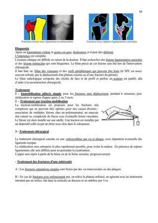 88
Fractures mixtes avec séparation et enfoncement Fractures avec ruptures ligamentaires associées
Diagnostic
Après un traumatisme violent, le genou est gros, douloureux et il peut être déformé.
L'impotence est complète.
L'examen clinique est difficile en raison de la douleur. Il faut rechercher des lésions ligamentaires associées
et des lésions méniscales qui sont fréquentes. Le bilan précis de ces lésions sera fait lors de l'intervention
chirurgicale.
Il faut faire un bilan des vaisseaux et des nerfs périphériques qui peuvent être lésés (le SPE est assez
souvent refoulé, par le déplacement d'un plateau externe ou d’une fracture du péroné).
Le bilan radiologique comporte des clichés de face et de profil et parfois un scanner est justifié, afin
d’aider à la reconstruction chirurgicale.
Traitement
1 - Immobilisation plâtrée simple pour les fractures sans déplacement, pendant 6 semaines, puis
rééducation et reprise d'appui après 2 ou 3 mois.
2 - Traitement par traction mobilisation
La traction-mobilisation est proposée pour les fractures très
complexes qui ne peuvent être opérées pour des causes diverses :
association de multiples lésions chez un polytraumatisé, un mauvais
état cutané ou complexité du fracas avec éventuelle lésion vasculaire.
Le blessé est alors installé sur une attelle. Une traction est installée par
un dispositif collé ou par un étrier avec clou dans le calcaneum.
3 - Traitement chirurgical
Le traitement chirurgical consiste en une ostéosynthèse par vis et plaque, avec réparation éventuelle des
ligaments rompus.
La rééducation sera entreprise le plus rapidement possible, pour éviter la raideur. En présence de rupture
ligamentaire elle sera différée pour en permettre la cicatrisation.
L'appui sera repris à partir de la 6ème ou de la 8ème semaine, progressivement.
- Traitement des fractures d'une tubérosité
A / Les fractures séparations simples sont fixées par des vis transversales ou des plaques
B / En cas de fractures avec enfoncement pur, on relève le plateau enfoncé, en agissant avec un instrument
introduit par un orifice, fait dans la corticale en dessous et on stabilise par 1vis.
 