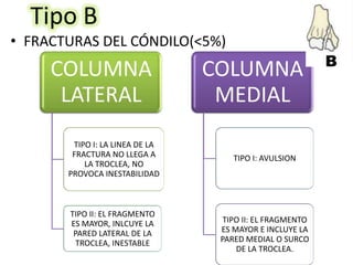 FRACTURA DE HUMERO DISTAL | PPTX