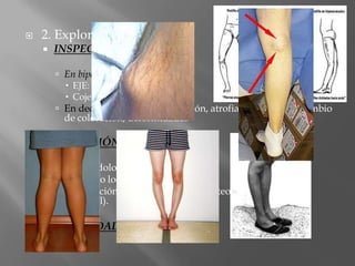    2. Exploración
       INSPECCIÓN

         En bipedestación:
           EJE: varo, valgo, recurvatum
           Cojera
         En decúbito supino: inflamación, atrofias musculares, cambio
          de coloración, deformidades

       PALPACIÓN

         puntos dolorosos a la presión
         aumento local de temperatura
         tumefacción posterior (quiste poplíteo) o lateral (quiste
          meniscal).

       MOVILIDAD
 