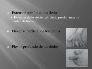    -Extensor común de los dedos
       Extender dedo afecto bajo cierta presión nuestra
        sobre dicho dedo


   -Flexor superficial de los dedos



   -Flexor profundo de los dedos
 