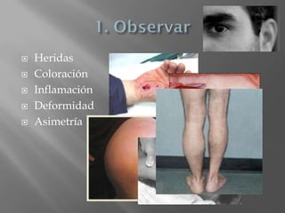    Heridas
   Coloración
   Inflamación
   Deformidad
   Asimetría
 