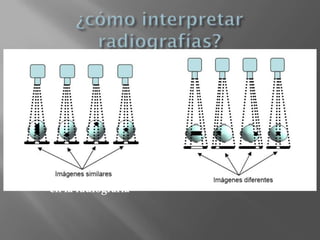    1. Sentido común: imagen bidimensional de
    estructuras tridimiensionales
   2. Ser sistemático:
      Integridad o no de las corticales
     Trazo de fractura
     Afectación de articulación
     Desviación de fragmentos
    3. Comprobar la zona que duele o donde hay clínica
       en la radiografía
 