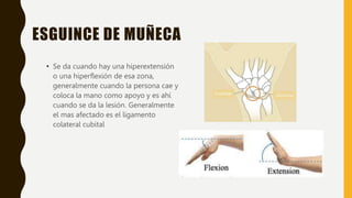 Traumatología exposicion ESGUINES Y LUXACIONES.pptx
