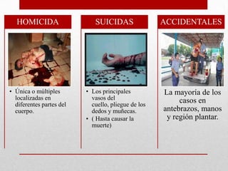 HOMICIDA                   SUICIDAS                ACCIDENTALES




• Única o múltiples       • Los principales          La mayoría de los
  localizadas en            vasos del                     casos en
  diferentes partes del     cuello, pliegue de los
  cuerpo.                   dedos y muñecas.         antebrazos, manos
                          • ( Hasta causar la         y región plantar.
                            muerte)
 