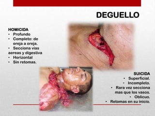 DEGUELLO
HOMICIDA
• Profundo
• Completo: de
  oreja a oreja.
• Secciona vías
aereas y digestiva
• Horizontal
• Sin retomas.


                                   SUICIDA
                              • Superficial.
                             • Incompleto.
                        • Rara vez secciona
                          mas que los vasos.
                                 • Oblicuo.
                      • Retomas en su inicio.
 