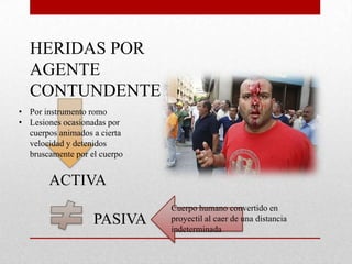 HERIDAS POR
  AGENTE
  CONTUNDENTE
• Por instrumento romo
• Lesiones ocasionadas por
  cuerpos animados a cierta
  velocidad y detenidos
  bruscamente por el cuerpo


       ACTIVA
                              Cuerpo humano convertido en
                   PASIVA     proyectil al caer de una distancia
                              indeterminada
 