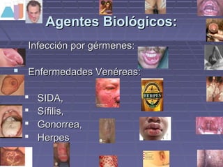 AAggeenntteess BBiioollóóggiiccooss:: 
IInnffeecccciióónn ppoorr ggéérrmmeenneess:: 
 EEnnffeerrmmeeddaaddeess VVeennéérreeaass:: 
 SSIIDDAA,, 
 SSííffiilliiss,, 
 GGoonnoorrrreeaa,, 
 HHeerrppeess 
 