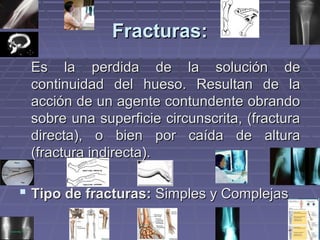 FFrraaccttuurraass:: 
EEss llaa ppeerrddiiddaa ddee llaa ssoolluucciióónn ddee 
ccoonnttiinnuuiiddaadd ddeell hhuueessoo.. RReessuullttaann ddee llaa 
aacccciióónn ddee uunn aaggeennttee ccoonnttuunnddeennttee oobbrraannddoo 
ssoobbrree uunnaa ssuuppeerrffiicciiee cciirrccuunnssccrriittaa,, ((ffrraaccttuurraa 
ddiirreeccttaa)),, oo bbiieenn ppoorr ccaaííddaa ddee aallttuurraa 
((ffrraaccttuurraa iinnddiirreeccttaa)).. 
 TTiippoo ddee ffrraaccttuurraass:: SSiimmpplleess yy CCoommpplleejjaass 
 