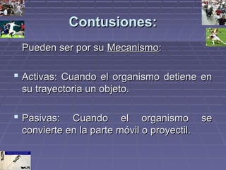 CCoonnttuussiioonneess:: 
PPuueeddeenn sseerr ppoorr ssuu MMeeccaanniissmmoo:: 
 AAccttiivvaass:: CCuuaannddoo eell oorrggaanniissmmoo ddeettiieennee eenn 
ssuu ttrraayyeeccttoorriiaa uunn oobbjjeettoo.. 
 PPaassiivvaass:: CCuuaannddoo eell oorrggaanniissmmoo ssee 
ccoonnvviieerrttee eenn llaa ppaarrttee mmóóvviill oo pprrooyyeeccttiill.. 
 