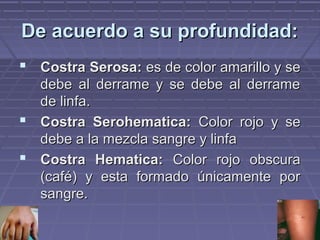 DDee aaccuueerrddoo aa ssuu pprrooffuunnddiiddaadd:: 
 CCoossttrraa SSeerroossaa:: eess ddee ccoolloorr aammaarriilllloo yy ssee 
ddeebbee aall ddeerrrraammee yy ssee ddeebbee aall ddeerrrraammee 
ddee lliinnffaa.. 
 CCoossttrraa SSeerroohheemmaattiiccaa:: CCoolloorr rroojjoo yy ssee 
ddeebbee aa llaa mmeezzccllaa ssaannggrree yy lliinnffaa 
 CCoossttrraa HHeemmaattiiccaa:: CCoolloorr rroojjoo oobbssccuurraa 
((ccaafféé)) yy eessttaa ffoorrmmaaddoo úúnniiccaammeennttee ppoorr 
ssaannggrree.. 
 
