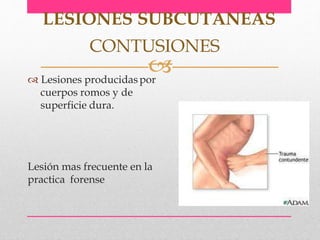  Lesiones producidaspor
cuerpos romos y de
superficie dura.
Lesión mas frecuente en la
practica forense
LESIONES SUBCUTANEAS
CONTUSIONES
 