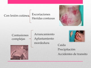 Con lesión cutánea Excoriaciones
Heridas contusas
Contusiones
complejas
Arrancamiento
Aplastamiento
mordedura
Caída
Precipitación
Accidentes de transito
 